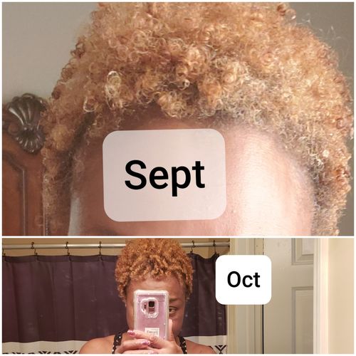 Customer photo review of PureFix Hair Elixir