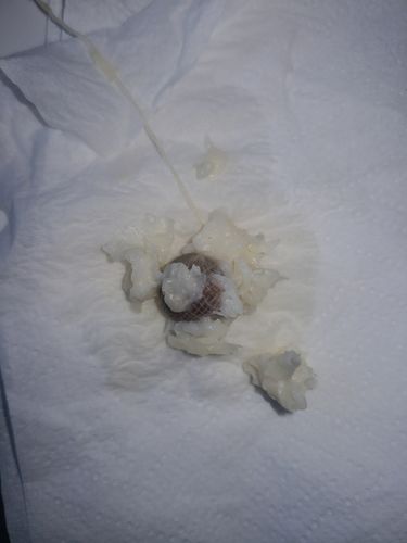 Customer photo review of Perle de Detox Vaginale (Lot de 3 perles par sachet)