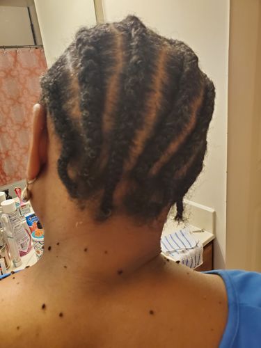 Customer photo review of PureFix Hair Elixir