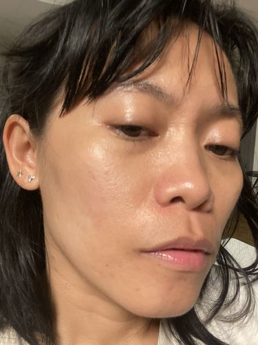 Customer photo review of (BOGO) AWAKEN: Skin Repair Intensive Healing Serum