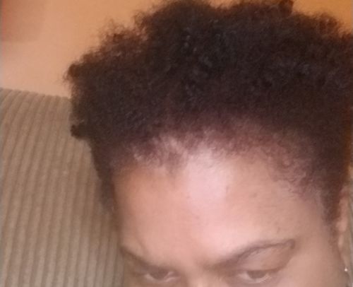 Customer photo review of Nae Nae's Hair Boost 9oz