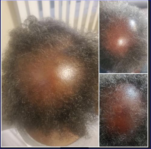 Customer photo review of PureFix Hair Elixir