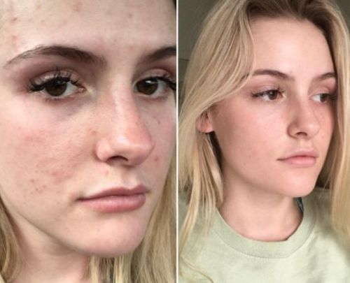 somebymi super matcha toner