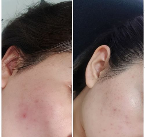 Customer photo review of Bio Vitalisierendes Gesichtsöl