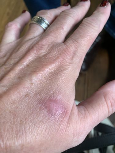 Customer photo review of Free Sample - Combat Ready Ointment