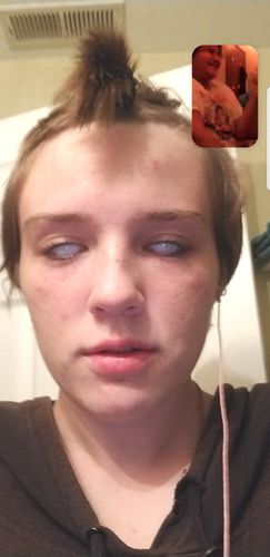 Customer photo review of Blind White Halloween Colored Contact Lenses