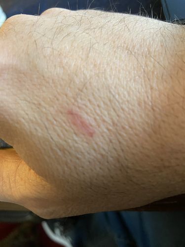Customer photo review of Combat Ready Ointment - Everyday Carry