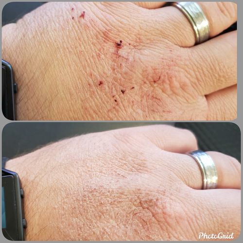 Customer photo review of Combat Ready Ointment - Everyday Carry