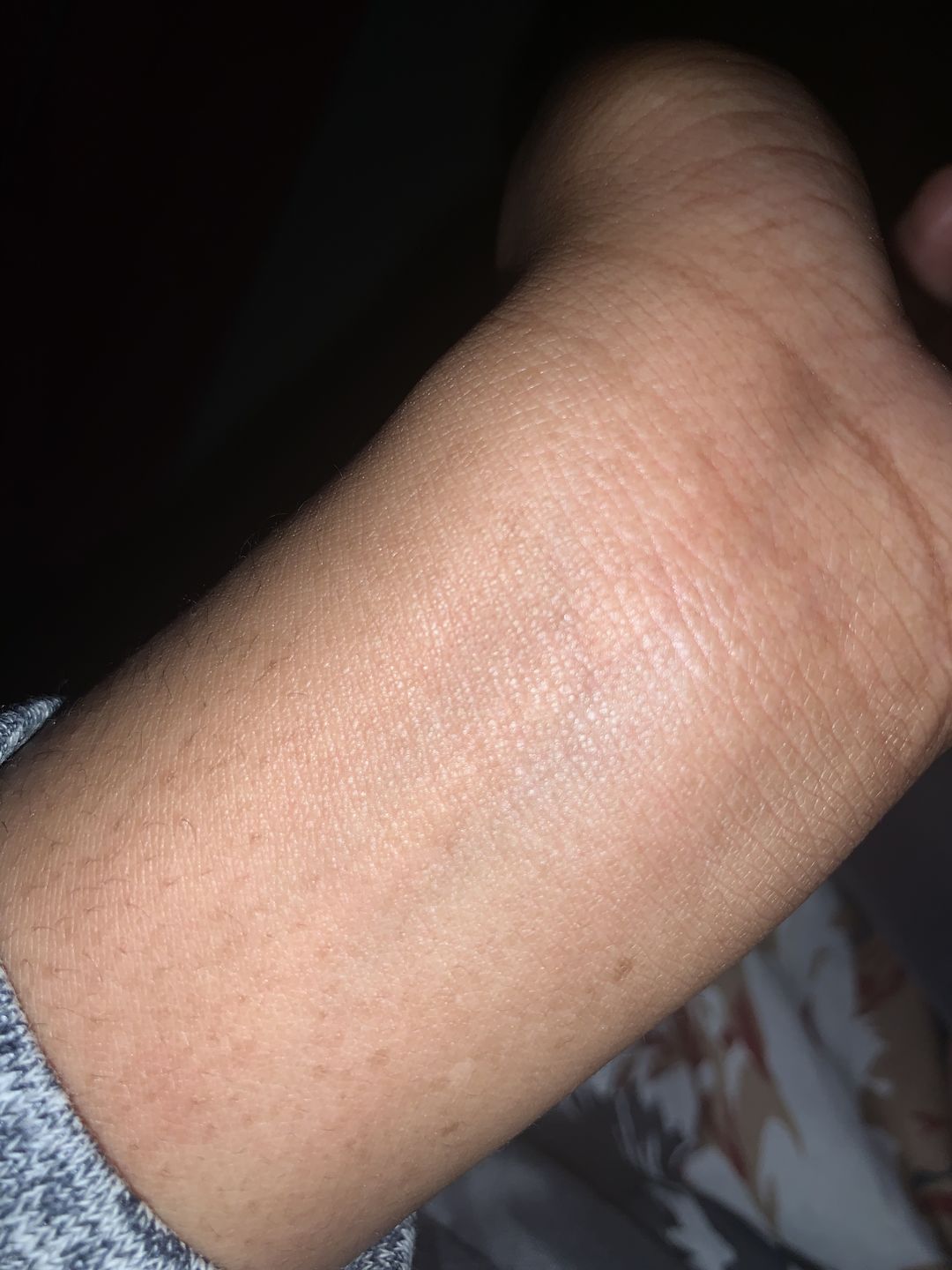 Customer photo review of Fair and White Miss White Body Lightening Lotion 7 days 500ml