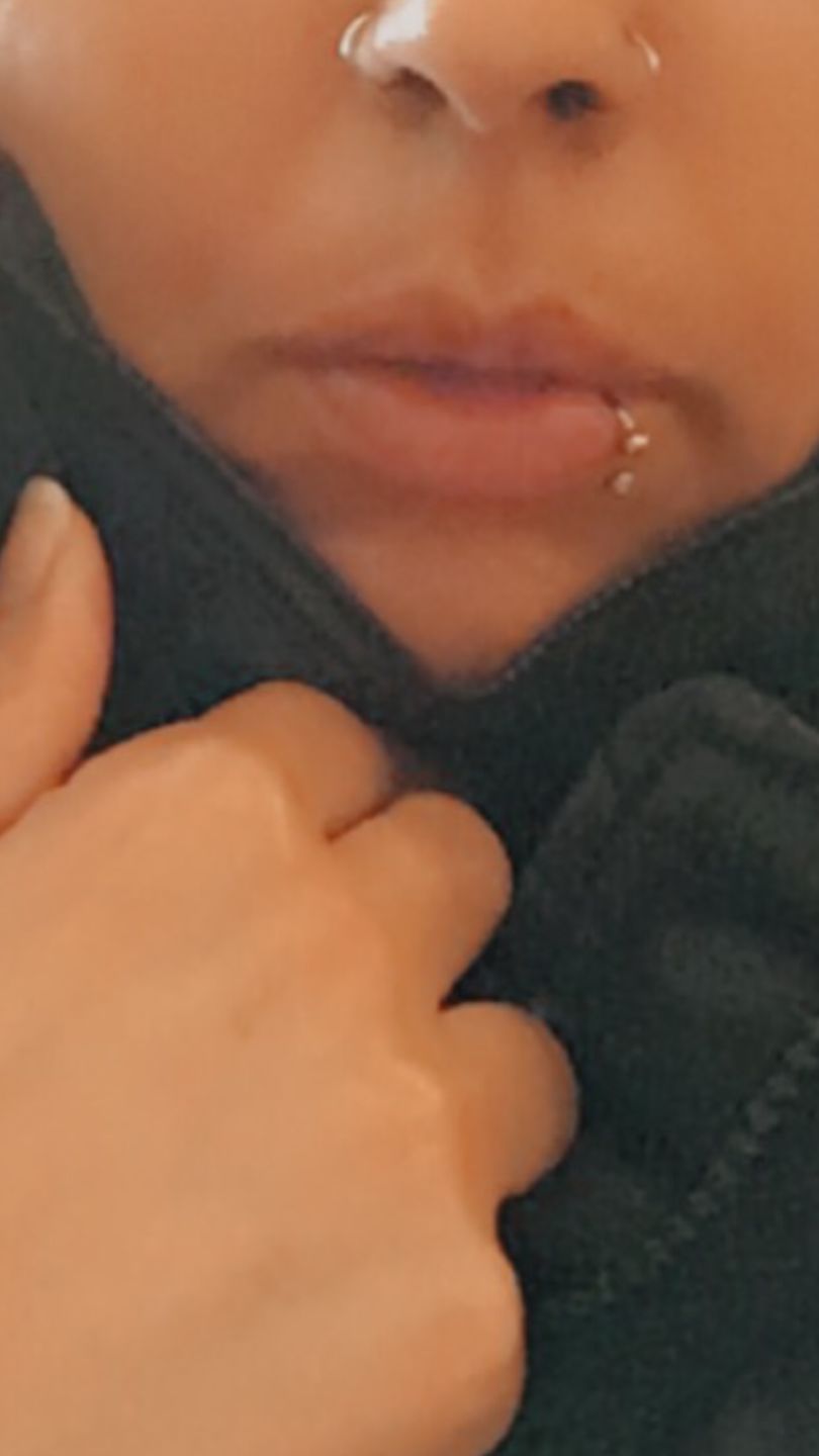 Customer photo review of NeilMed Sterile Saline Piercing Aftercare