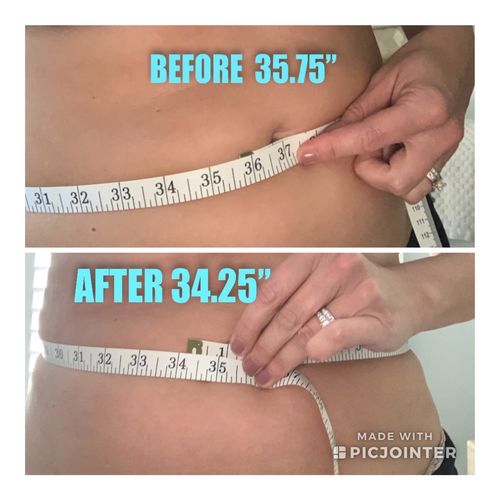 Customer photo review of 45 Uses Herbal Magnesium Therapy Wrap: Legs/Core