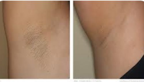 Customer photo review of TOP DEO CREAM PROMO PACKAGE