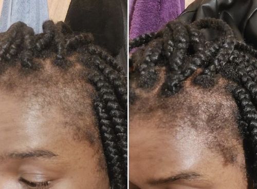 Customer photo review of Inches - Hair & Beard Growth Oil