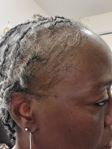 Customer photo review of PureFix Hair Elixir