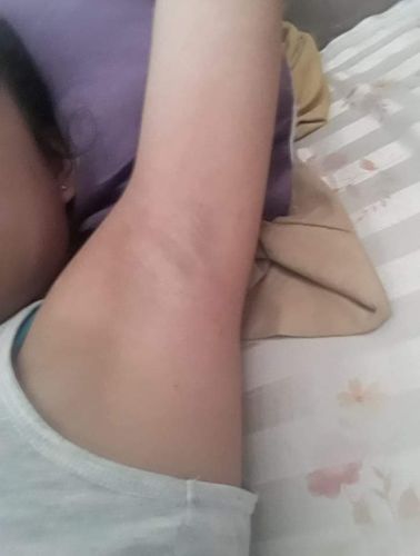 Customer photo review of TOP DEO CREAM PROMO PACKAGE