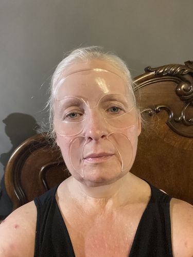 Customer photo review of Anti-Wrinkle Patches for Face Lift