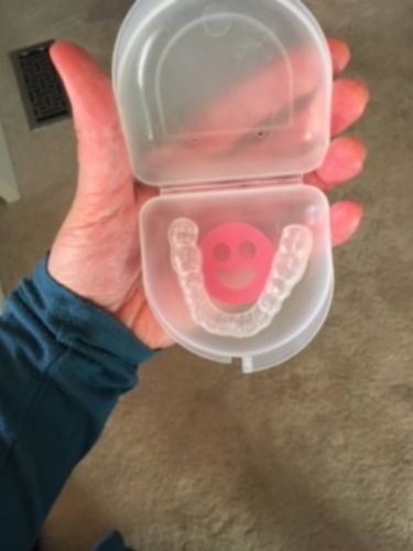 Customer photo review of Night Guard