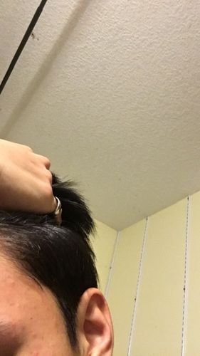 Customer photo review of Serum Concentrate Kit