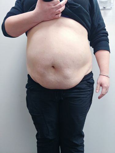 Customer photo review of 90 Uses Full Body with Renewal Serum, Awaken Serum