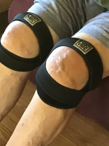 Customer photo review of PositVibe Patella Stabilizer