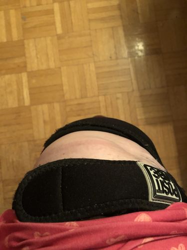 Customer photo review of PositVibe Patella Stabilizer