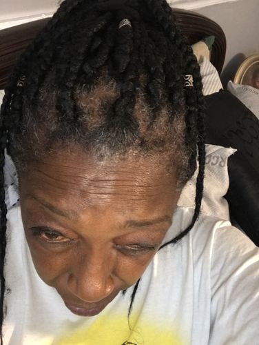 Customer photo review of PureFix Hair Elixir