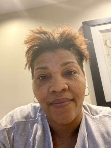 Customer photo review of PureFix Hair Elixir