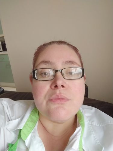 Customer photo review of SkinGlow Electric Cleanser - No More Blackheads