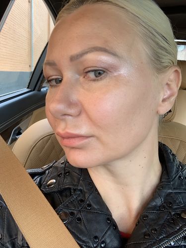 Customer photo review of MesoFirm Serum