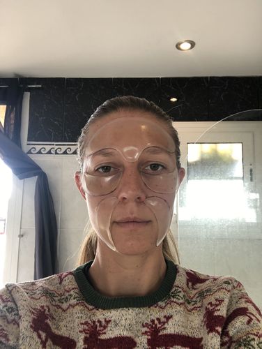 Customer photo review of Anti-Wrinkle Patches (All-in-one)