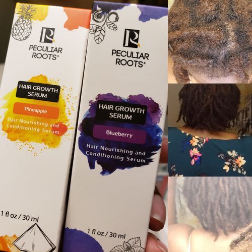 Customer photo review of Hair Growth Serum | 1 oz