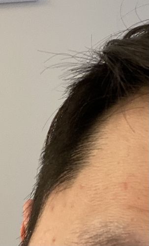 Customer photo review of Serum Concentrate Kit