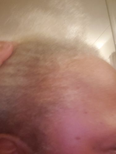 Customer photo review of PureFix Hair Elixir