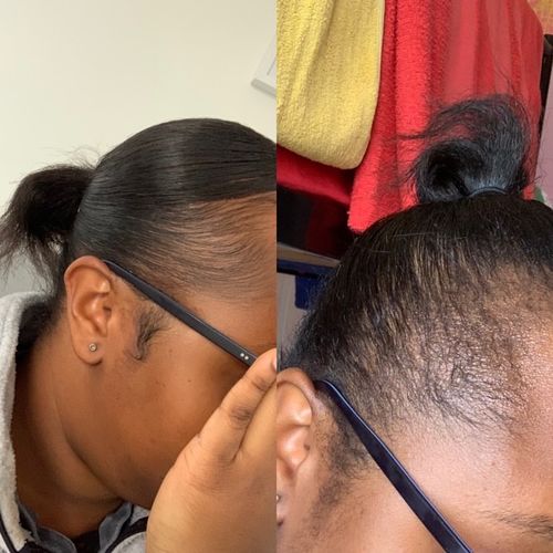 Customer photo review of Inches - Hair & Beard Growth Oil