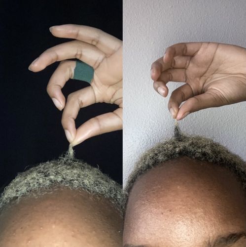 Customer photo review of Inches - Hair & Beard Growth Oil