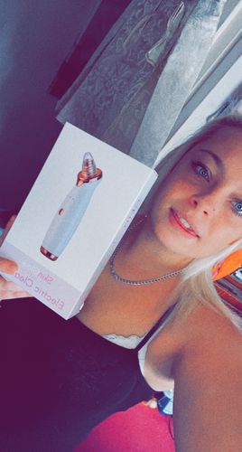 Customer photo review of SkinGlow Electric Cleanser - No More Blackheads