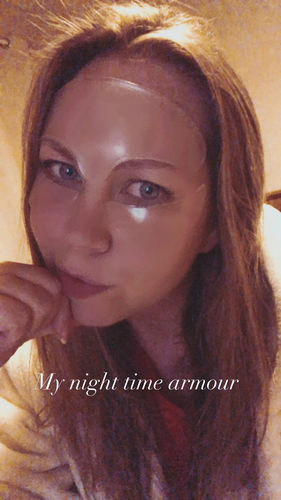 Customer photo review of Anti-Wrinkle Patches (All-in-one)