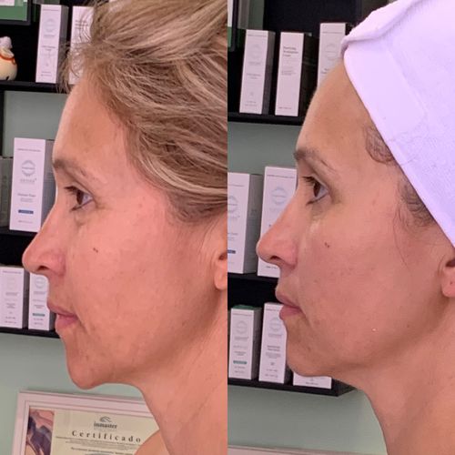 Customer photo review of Active-C Massage Cream, 1000ml/33.8 oz