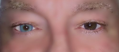 Customer photo review of 3-Tone Gemstone Green Contact Lenses