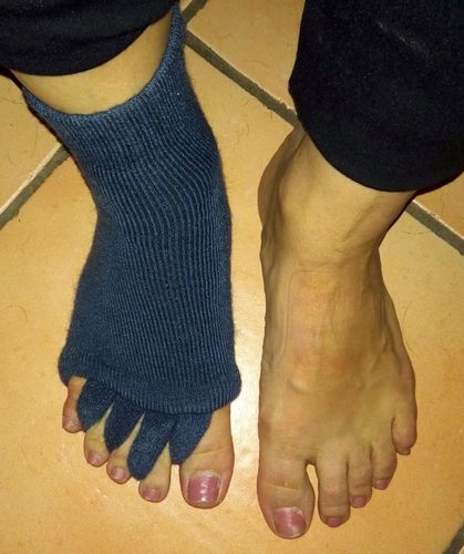 Customer photo review of ZEHENSPREIZER Socken - die sanfte Entspannung bei Hallux Valgus und Zehenfehlstellungen
