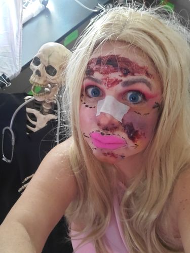 Customer photo review of Pixie Blue Prescription Contact Lenses