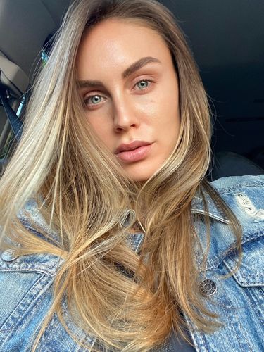 Customer photo review of Advanced Hyaluronic Acid Serum