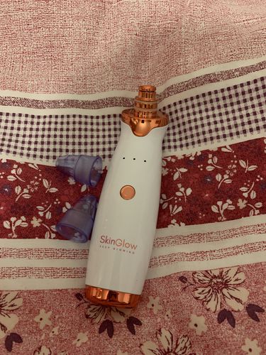Customer photo review of SkinGlow Electric Cleanser - No More Blackheads