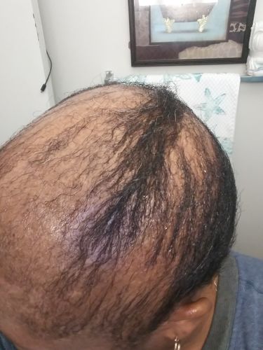 Customer photo review of PureFix Hair Elixir