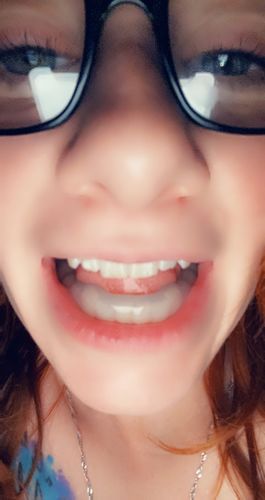 Customer photo review of SleepPro Night Guard