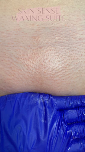 Customer photo review of Signature Series Hair Removal Wax