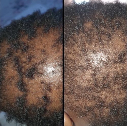 Customer photo review of Inches - Hair & Beard Growth Oil