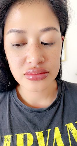 Customer photo review of Scalpa HyaInfuse