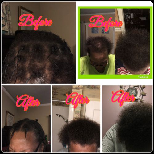 Customer photo review of PureFix Hair Elixir