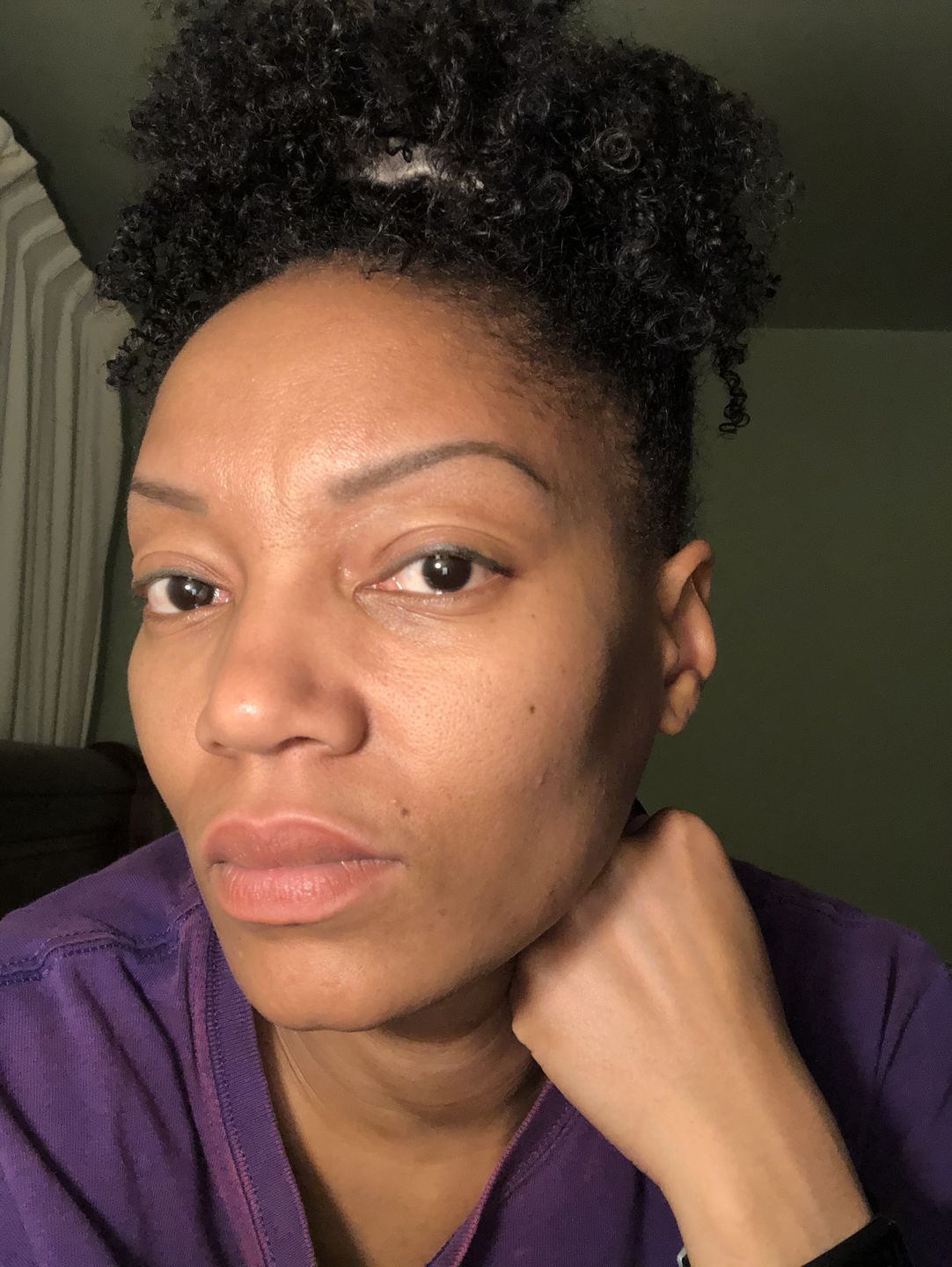 Customer photo review of Bolden Clear Skin Kit